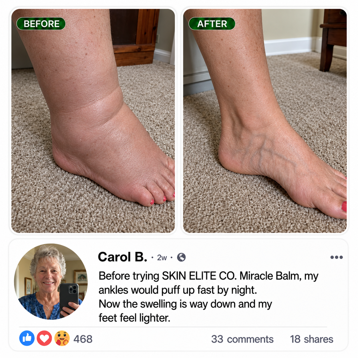 Reference before-and-after customer result layout