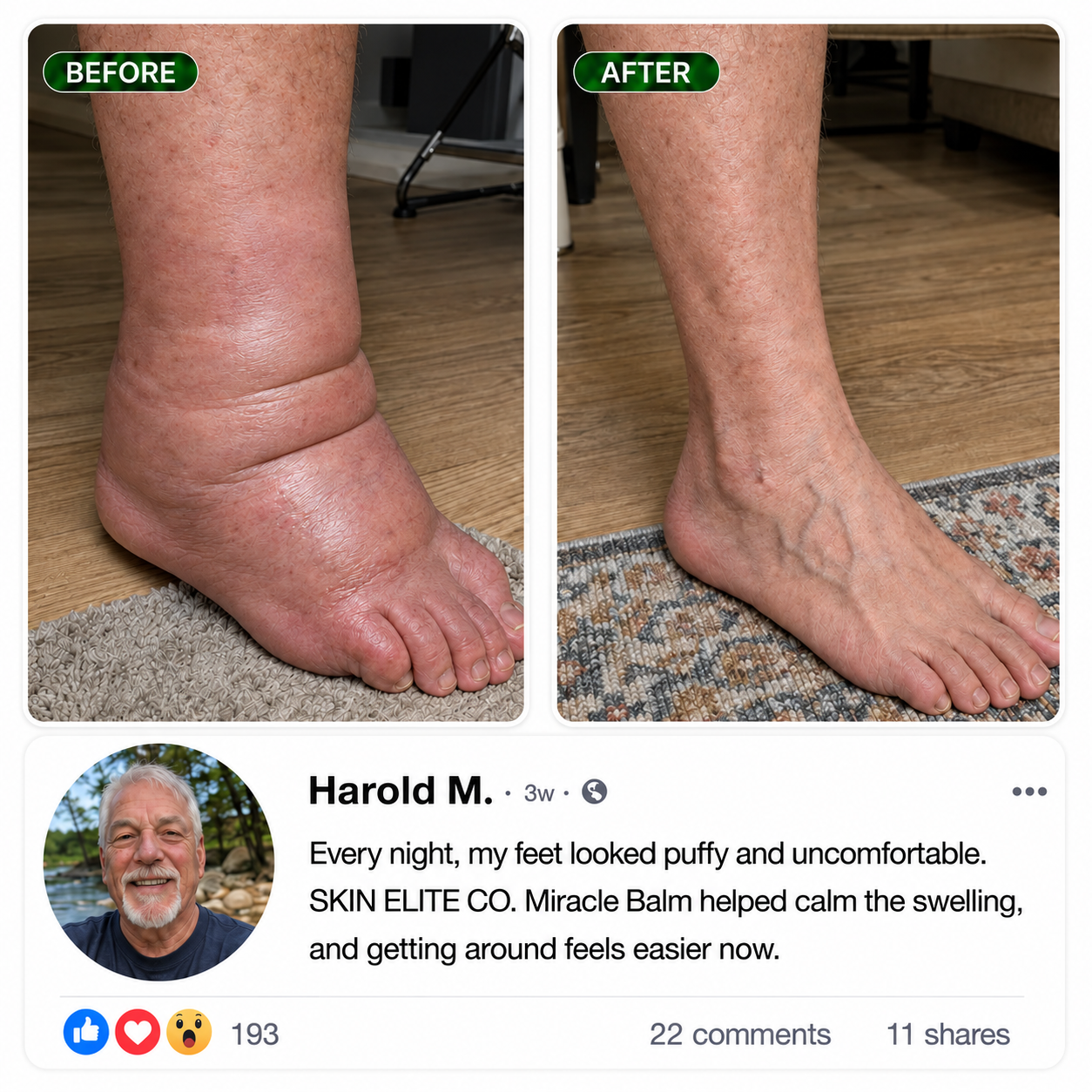 Third reference before-and-after customer result layout